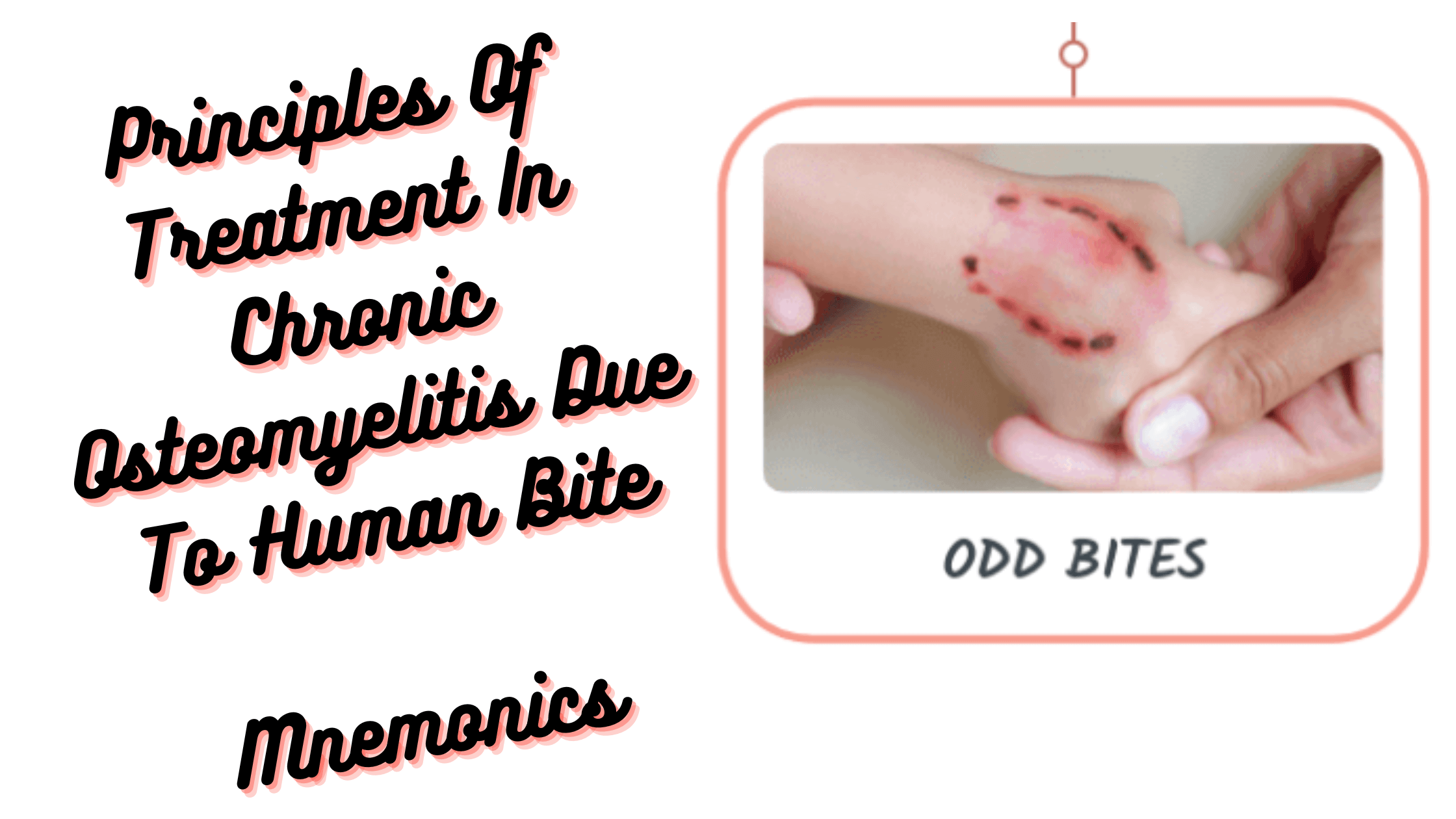 You are currently viewing Mnemonic: Chronic Osteomyelitis Treatment Secondary to Human Bite