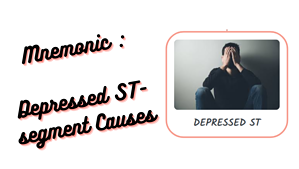 Depressed ST-segment Causes Medical Mnemonics