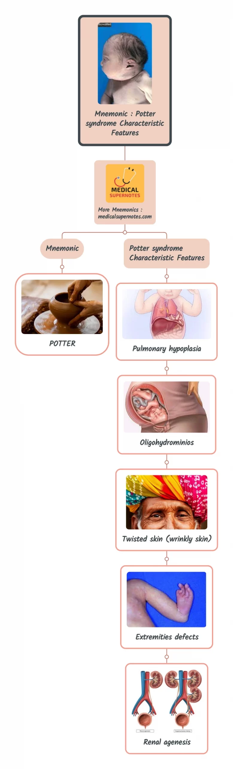 Mnemonic _ Potter syndrome Characteristic Features