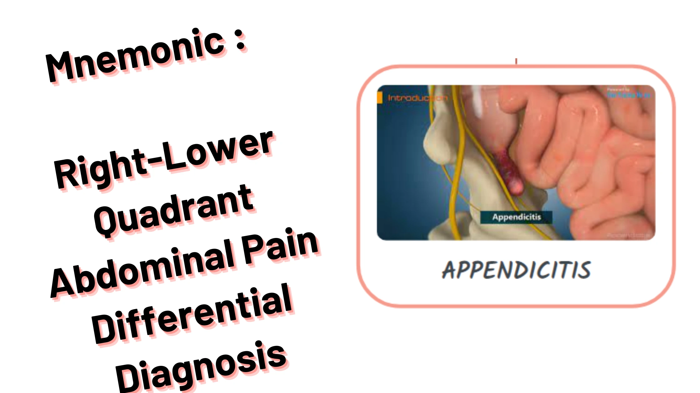 Right-Lower Quadrant Abdominal Pain Differential Diagnosis Medical Mnemonics