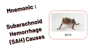 Subarachnoid Hemorrhage (SAH) Causes Medical Mnemonic