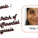 White Patch of Skin Differential Diagnosis