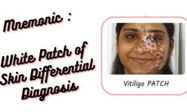 Mnemonic : White Patch of Skin Differential Diagnosis