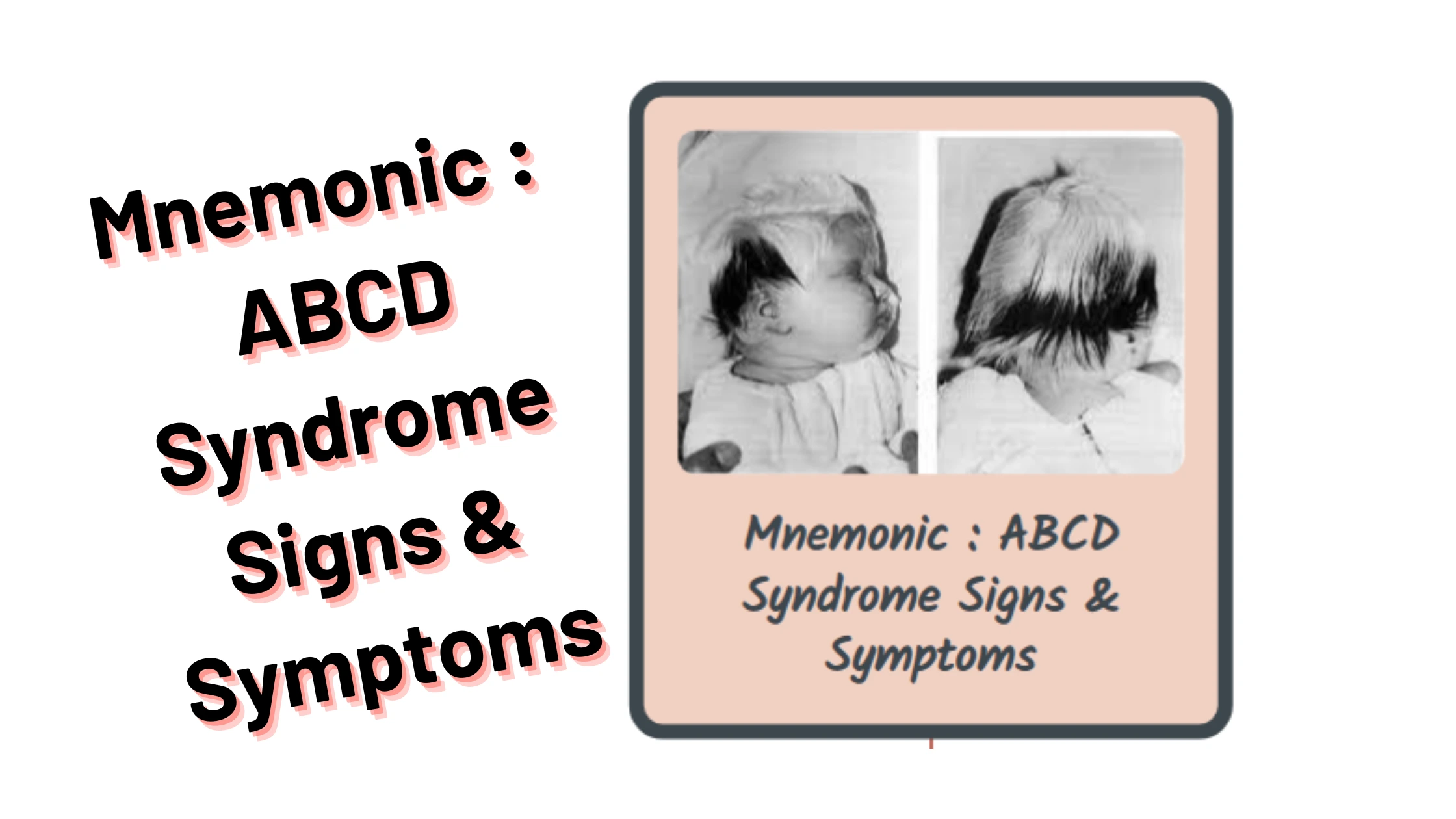 ABCD Syndrome Signs & Symptoms Medical & Nursing Mnemonics