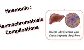 Mnemonic : Haemachromatosis Complications