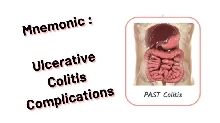 Read more about the article Mnemonic : Ulcerative Colitis Complications