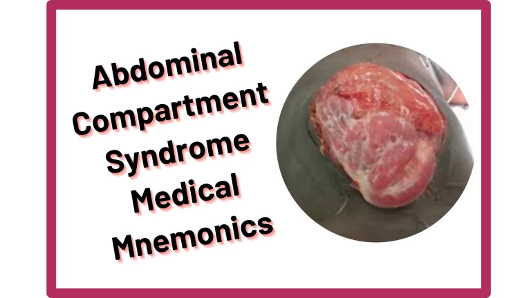 Read more about the article [Very Cool] Mnemonic : Abdominal Compartment Syndrome Signs & Symptoms