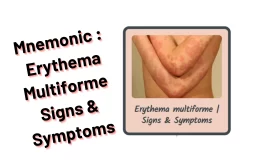 [Very Cool] Mnemonic : Erythema Multiforme Signs & Symptoms