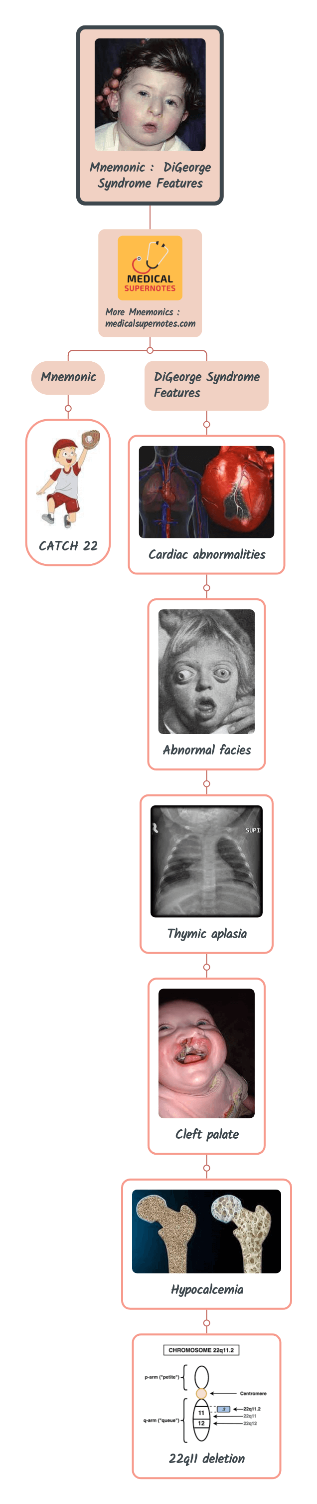 Mnemonic _ DiGeorge Syndrome Features