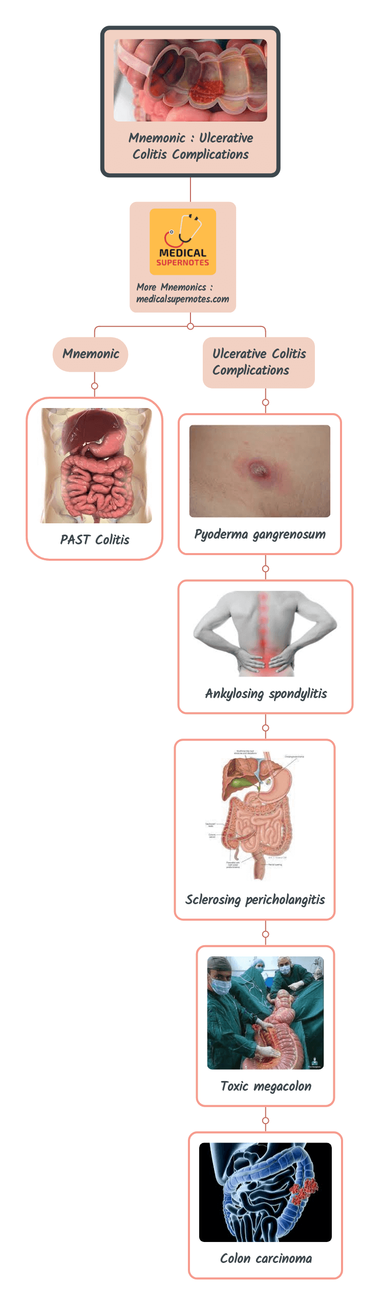 Mnemonic _ Ulcerative Colitis Complications