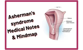 ASHERMAN’S Syndrome Medical Notes & Mindmap