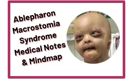 Ablepharon Macrostomia Syndrome :‎ Medical Notes & Mindmap