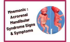 [Very Cool] Mnemonic : Acrorenal Mandibular Syndrome Signs & Symptoms