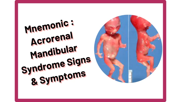 Read more about the article [Very Cool] Mnemonic : Acrorenal Mandibular Syndrome Signs & Symptoms