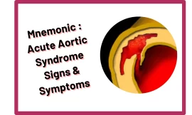 [Very Cool] Mnemonic : Acute Aortic Syndrome Signs & Symptoms