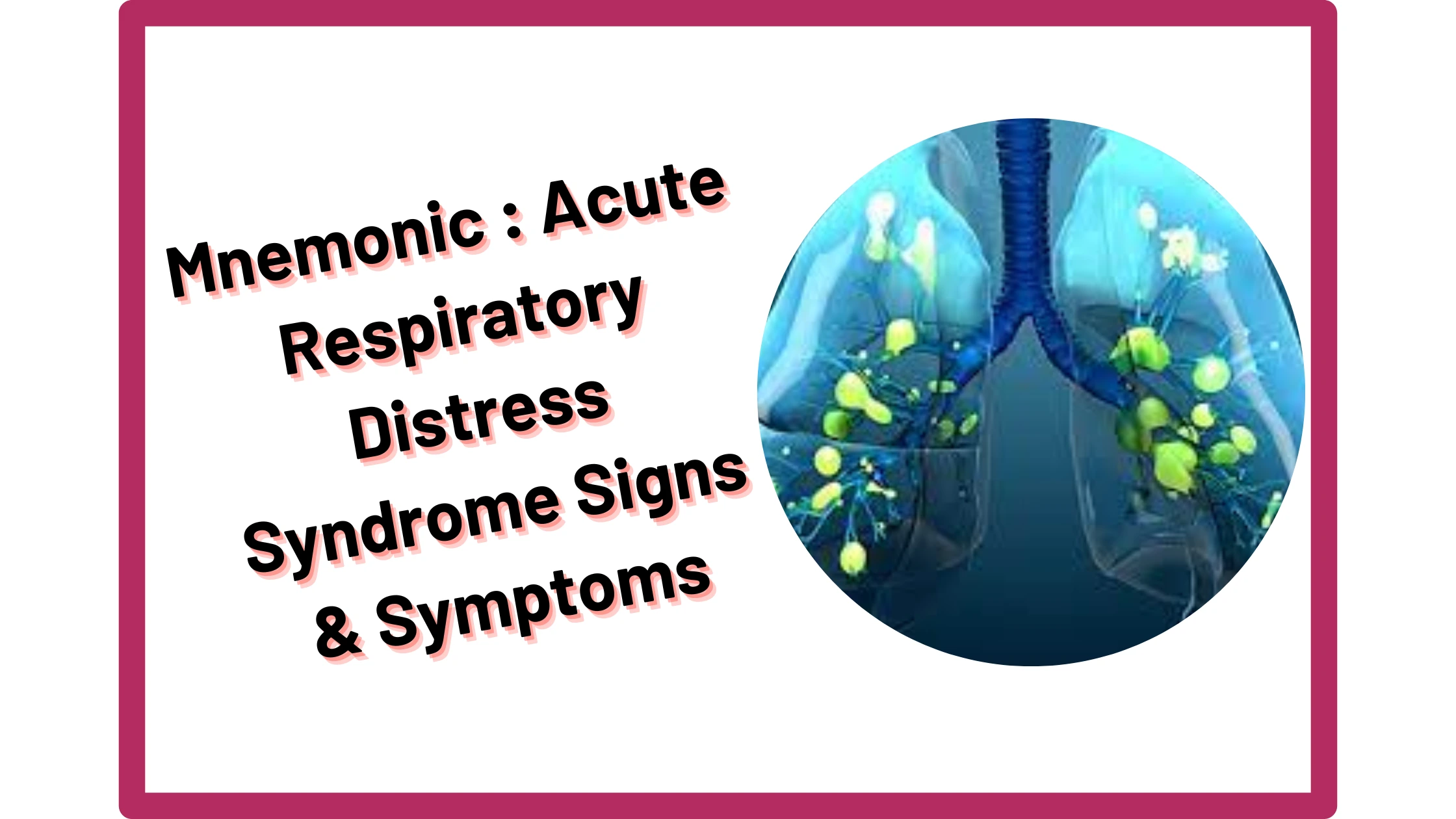 You are currently viewing [Very Cool] Mnemonic : Acute Respiratory Distress Syndrome Signs & Symptoms