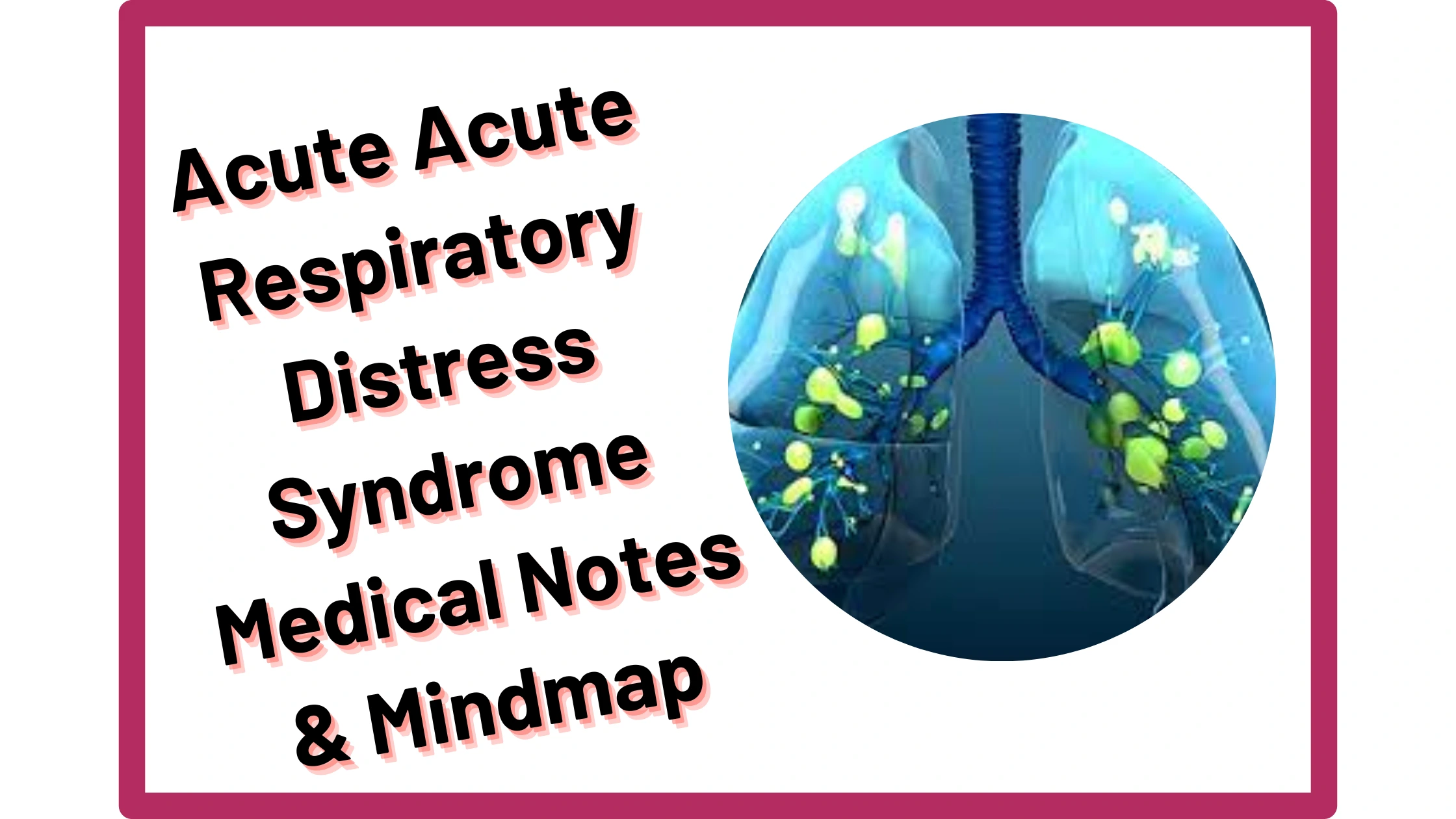You are currently viewing Acute Respiratory Distress Syndrome :‎ Medical Notes & Mindmap