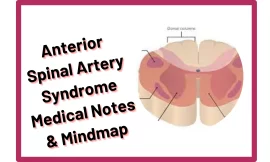 Anterior Spinal Artery Syndrome :‎ Medical Notes & Mindmap