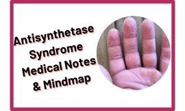 Antisynthetase Syndrome :‎ Medical Notes & Mindmap