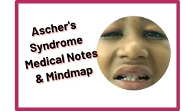 Ascher’s Syndrome :‎ Medical Notes & Mindmap