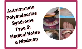 Autoimmune Polyendocrine Syndrome Type 3 :‎ Medical Notes & Mindmap