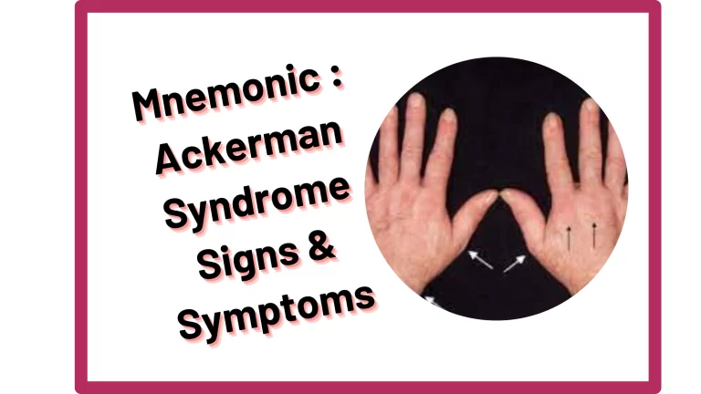 Read more about the article [Very Cool] Mnemonic : Ackerman Syndrome Signs & Symptoms