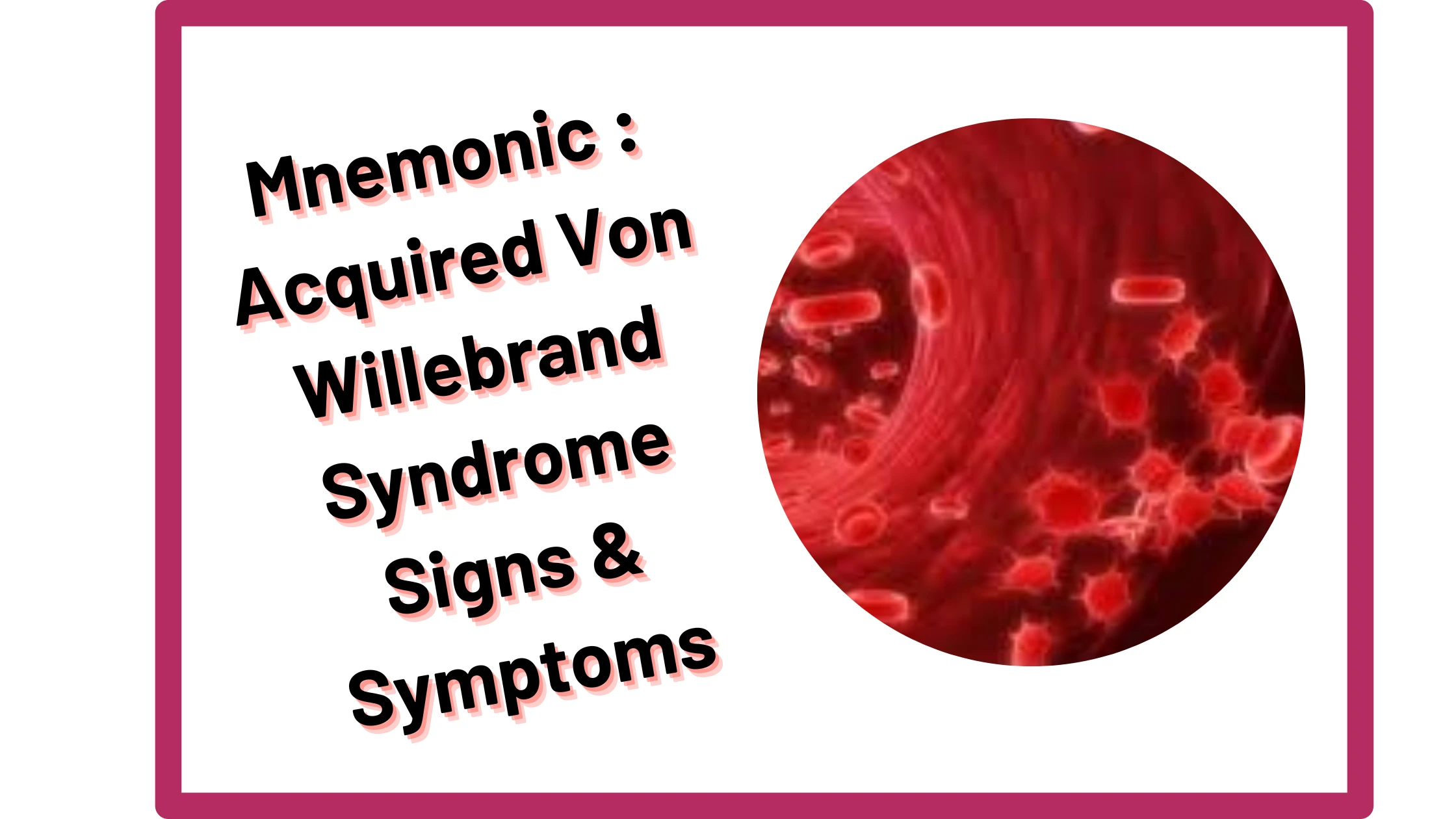 You are currently viewing [Very Cool] Mnemonic : Acquired Von Willebrand Syndrome Signs & Symptoms