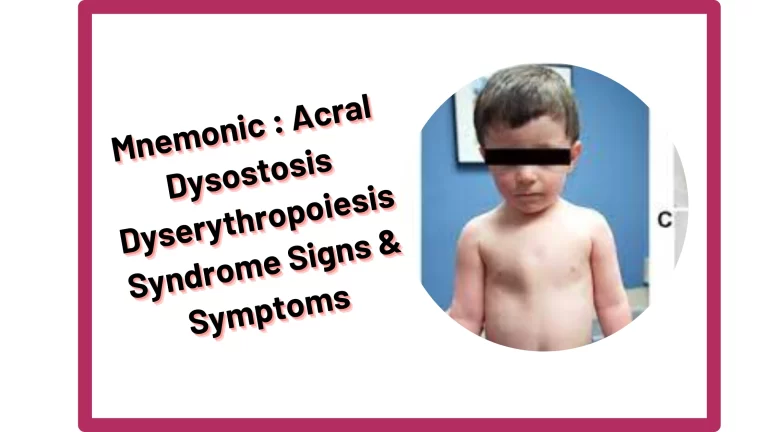Read more about the article [Very Cool] Mnemonic : Acral Dysostosis Dyserythropoiesis Syndrome Signs & Symptoms