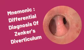 [Very Cool] Mnemonic : Differential Diagnosis Of Zenker’s Diverticulum
