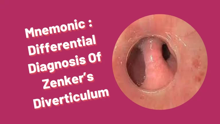 Read more about the article [Very Cool] Mnemonic : Differential Diagnosis Of Zenker’s Diverticulum
