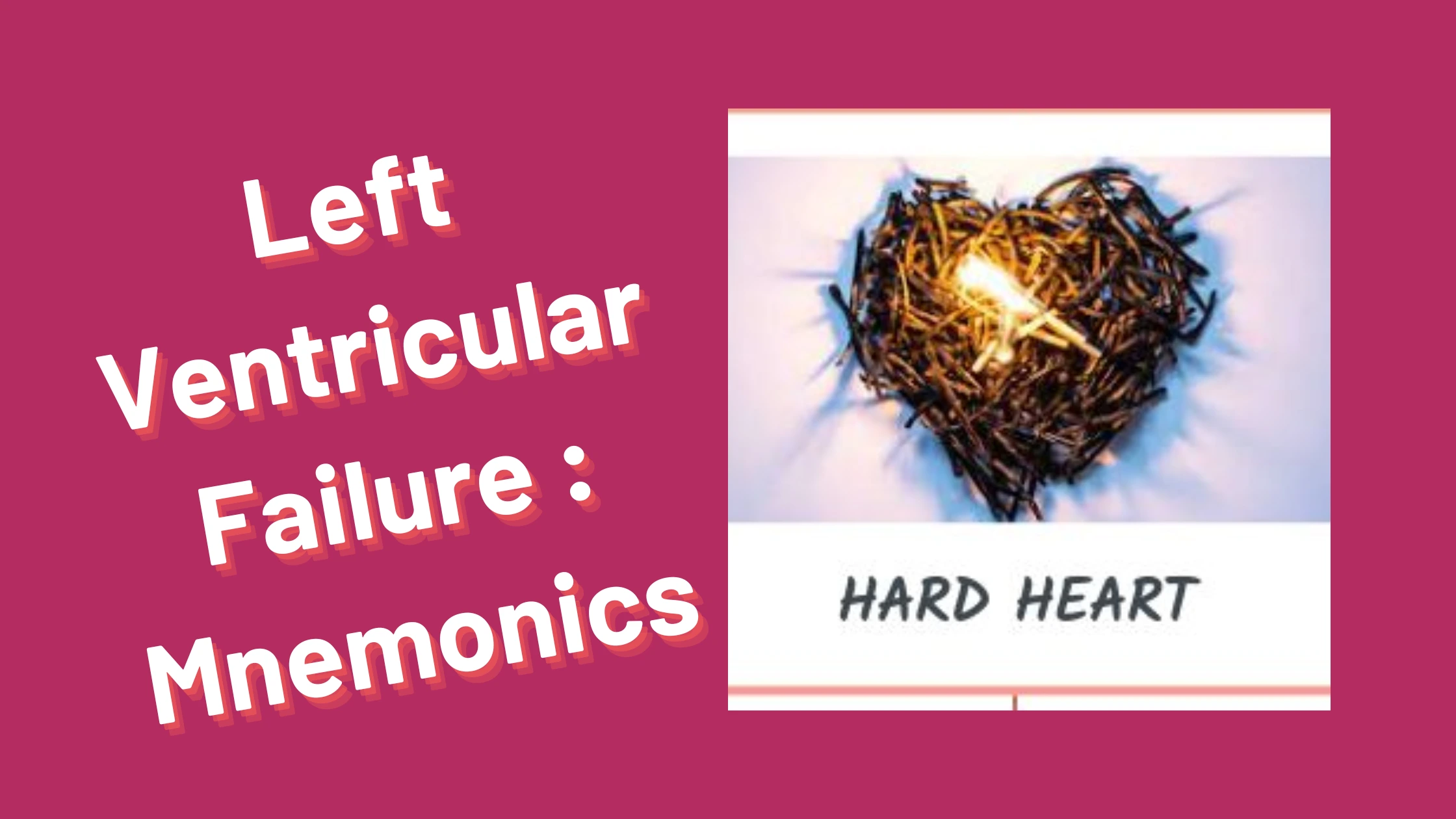You are currently viewing Left Ventricular Failure : Mnemonics [Remember Easily]