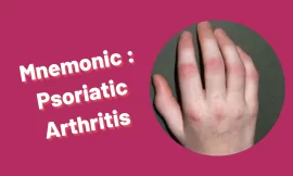 [Very Cool] Mnemonic : Psoriatic arthritis
