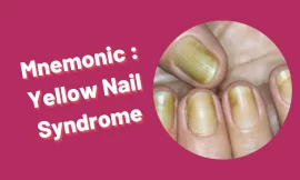 [Very Cool] Mnemonic : Yellow Nail Syndrome
