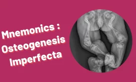 [Very Cool] Mnemonic : Osteogenesis Imperfecta