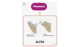 ALPSA Lesion : Mnemonics [NEVER FORGET AGAIN]