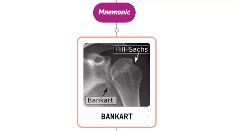 Read more about the article Bankart Lesion : Mnemonics [NEVER FORGET AGAIN]