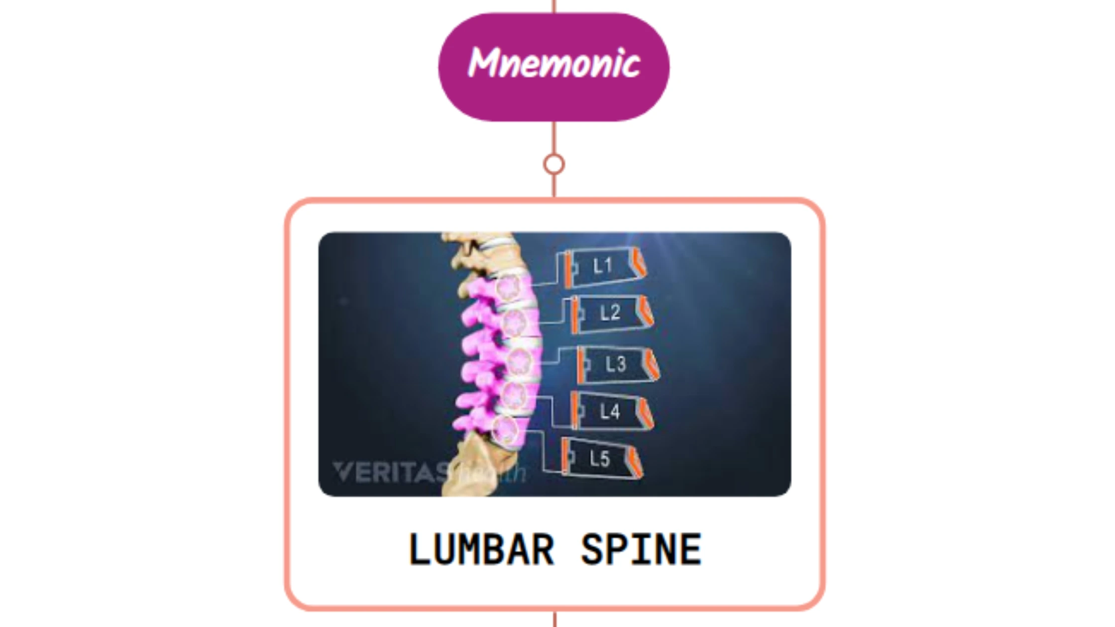 You are currently viewing Congenital Anomalies Of The Lumbar Spine : Mnemonics