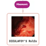 Read more about the article Dieulafoy’s Lesion : Mnemonics [NEVER FORGET AGAIN]
