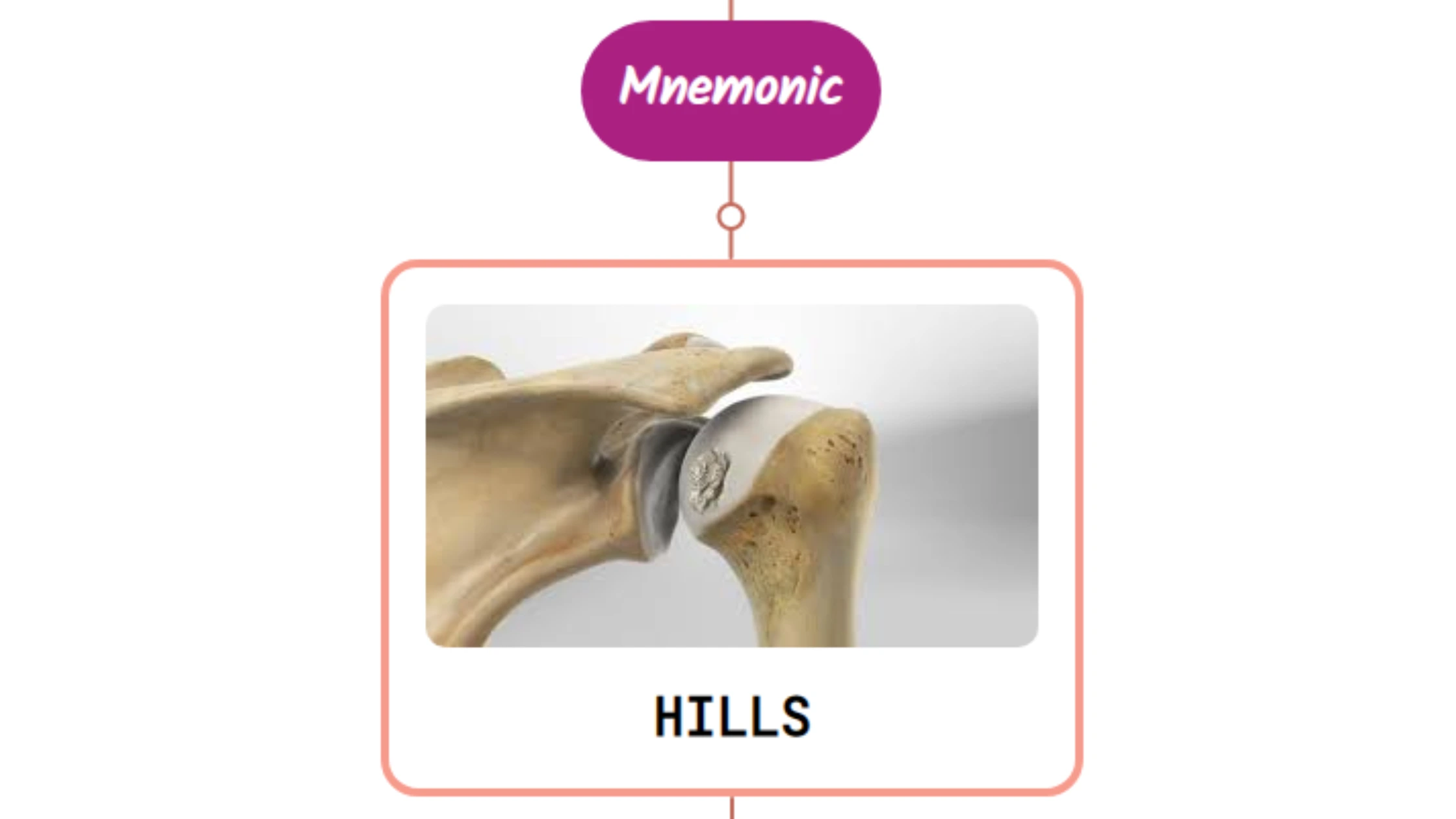 You are currently viewing Hill-Sachs Lesion Mnemonics [NEVER FORGET AGAIN]
