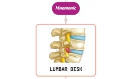 Lumbar Disk Disease : Mnemonics