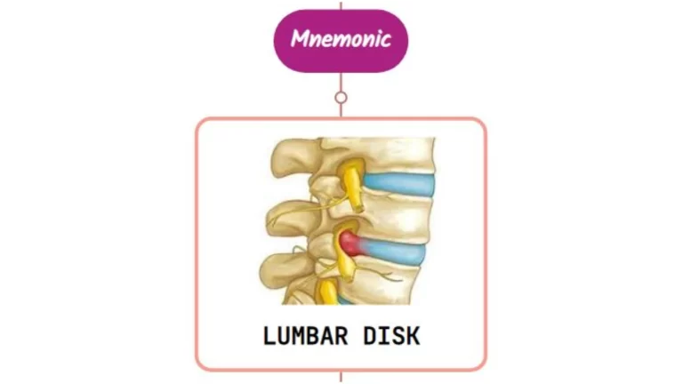 Read more about the article Lumbar Disk Disease : Mnemonics