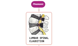 Lumbar Spinal Stenosis : Mnemonics