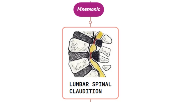 Read more about the article Lumbar Spinal Stenosis : Mnemonics