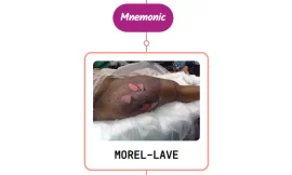 Morel-Lavallee Lesion : Mnemonics [NEVER FORGET AGAIN]