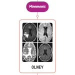 Read more about the article Olney’s Lesions Mnemonics [NEVER FORGET AGAIN]