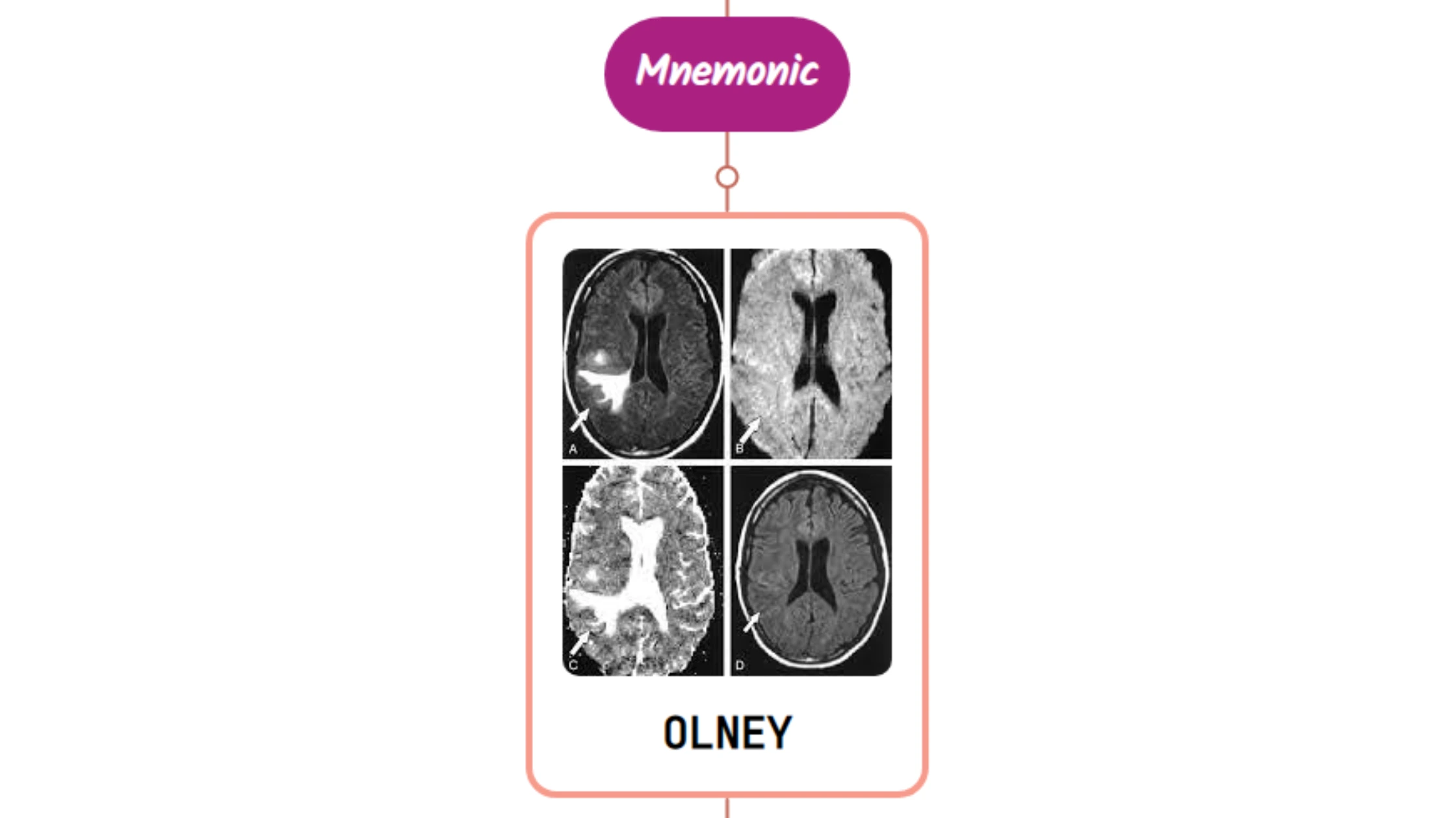 You are currently viewing Olney’s Lesions Mnemonics [NEVER FORGET AGAIN]