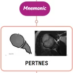 Read more about the article Pertnes Lesion : Mnemonics [NEVER FORGET AGAIN]