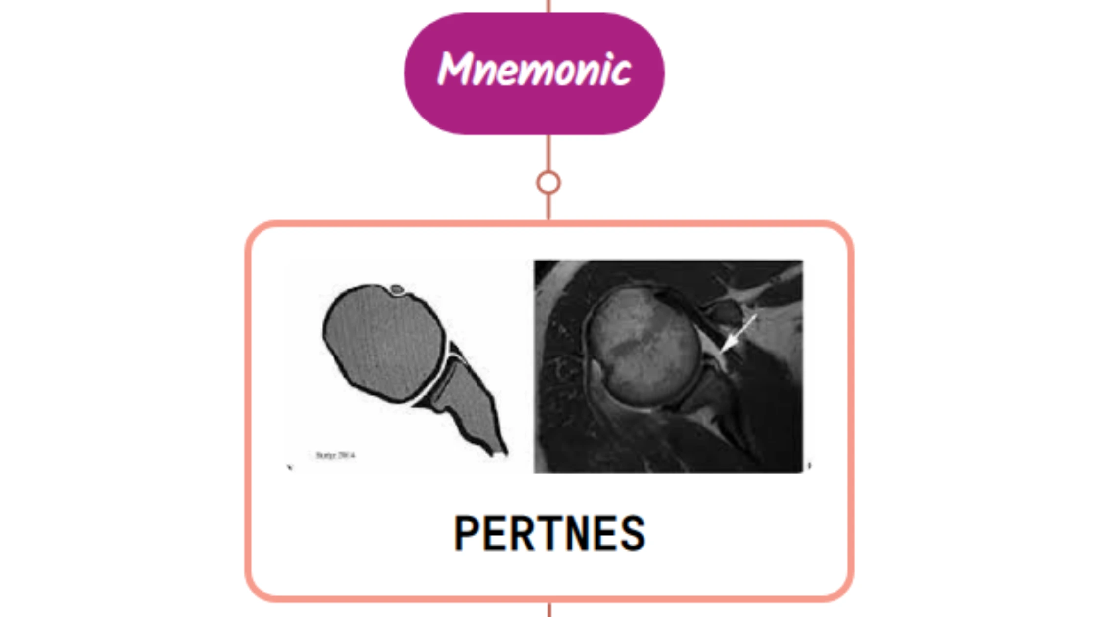 You are currently viewing Pertnes Lesion : Mnemonics [NEVER FORGET AGAIN]