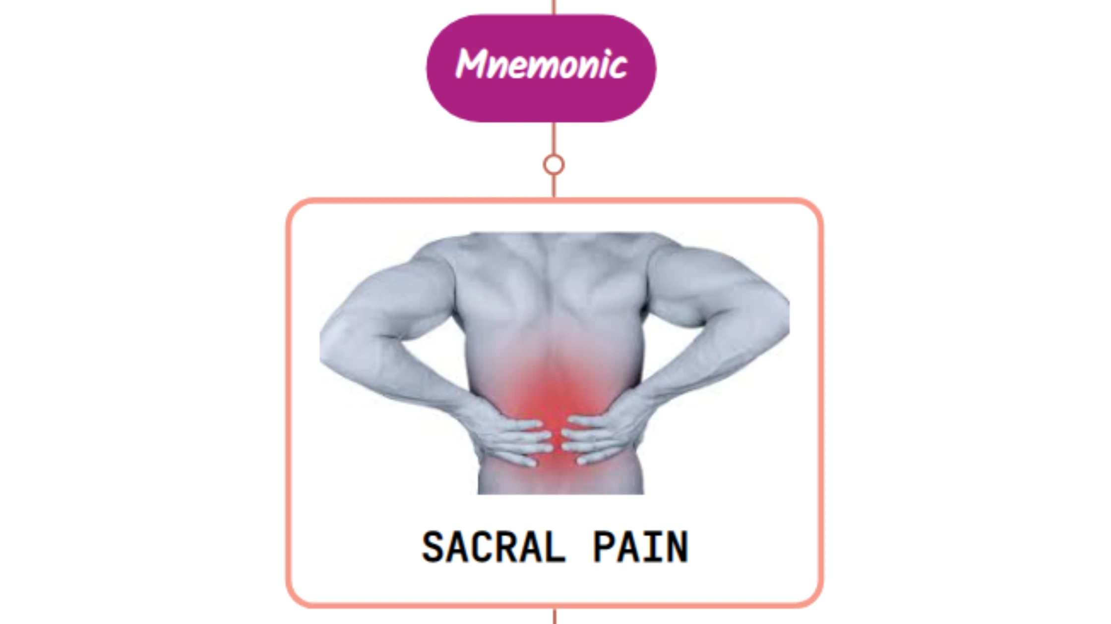 You are currently viewing Sacral Pain with Gynecologic and Urologic Disease : Mnemonics