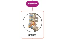 Spondylolisthesis Important Facts : Mnemonics